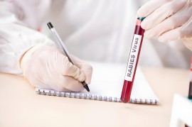 体检可以检查出来hpv吗 （体检中是否能检查出HPV）