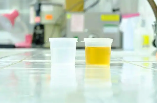 国企肾结石入职体检过不了？第1张-温百百科