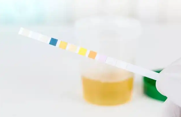 事业编体检对尿酸的要求第1张-温百百科